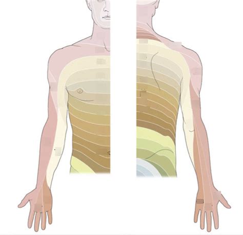 Dermatome Map Of Upper Body Diagram Diagram Quizlet Sexiz Pix