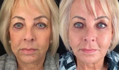 Real Life 66 Year Old Woman Credits Youthful Appearance To Tweakments But Gives Warning