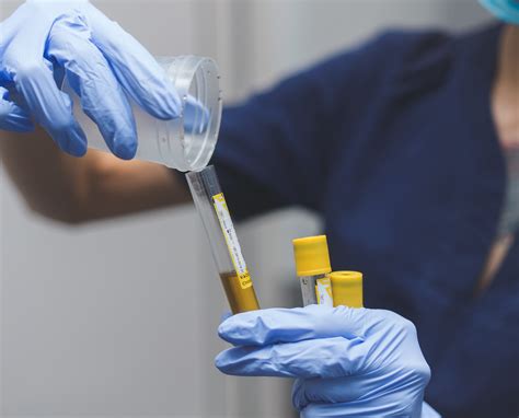 How To Avoid a "Negative Dilute" On Your Drug Test - Fleet Drug Testing