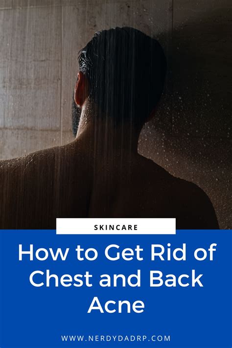 How To Get Rid Of Chest And Back Acne Nerdy Dad Rp