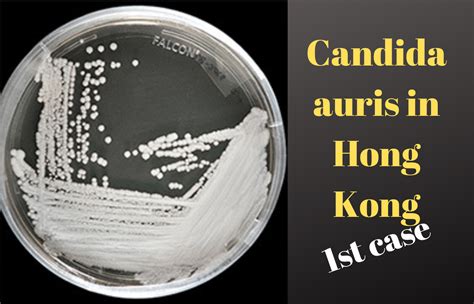 1st Case Of Candida Auris In Hong Kong Outbreak News Today
