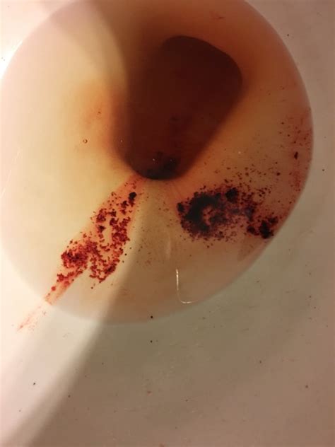 Which is great news for anyone who has had to work through the holidays in selecting or selling a medicare program. Grainy period blood. - Glow Community