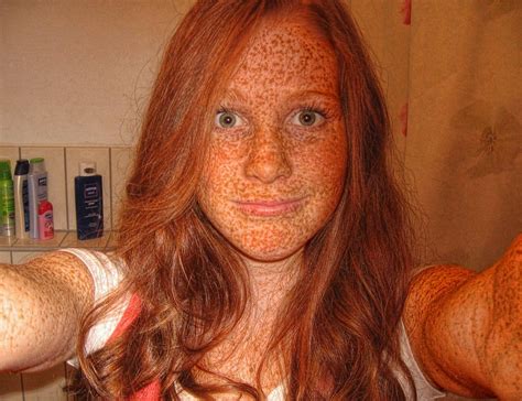 More Freckly Redheads Though I Think She Has More Freckled Area Than