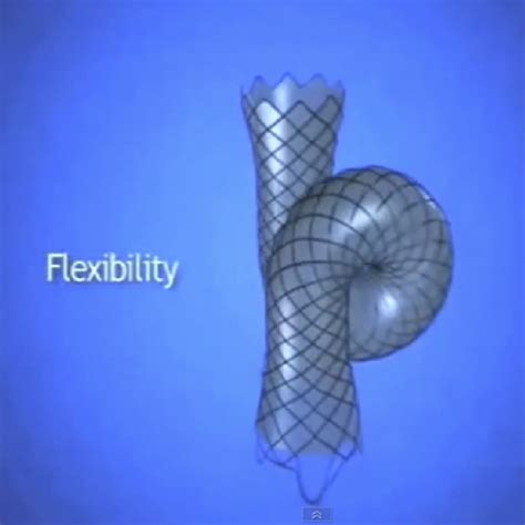 Stents Biliares Wallflex Rx Boston Scientific