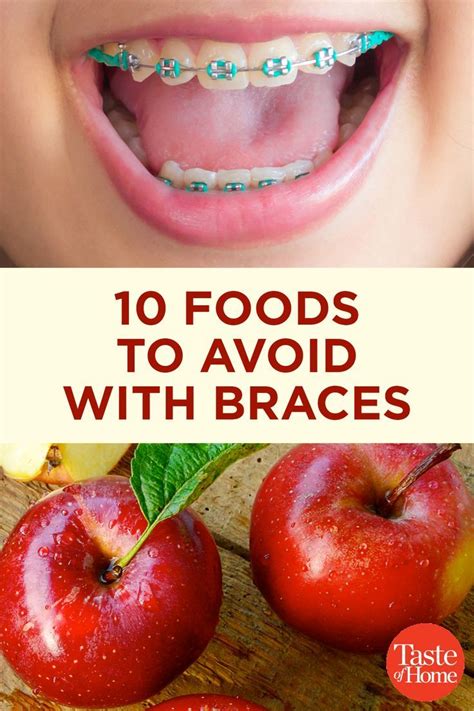 Printable List Of Foods To Avoid With Braces