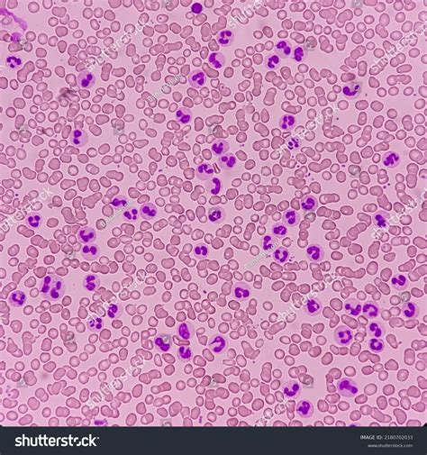 Neutrophilic Myelocyte 353 Images Photos Et Images Vectorielles De