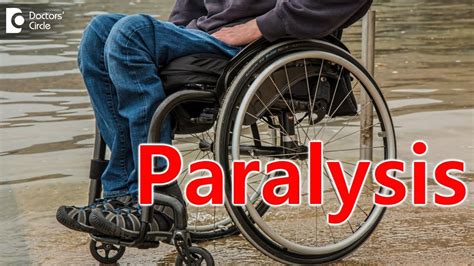 Paralysis Causes Signs And Symptoms Types Youtube