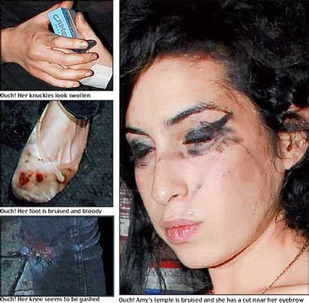 Amy Winehouse Est Morta Fotos Da Carreira Antes E Depois Da Cantora