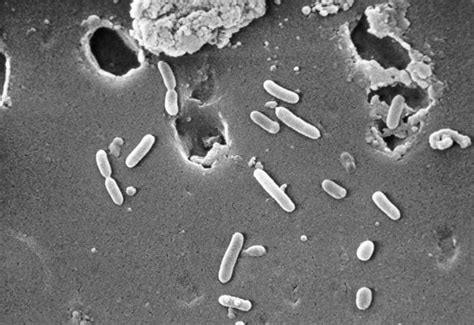 Pseudomonas aeruginosa is a type of germ that can cause infections in humans, mostly in hospital patients. Details - Public Health Image Library(PHIL)