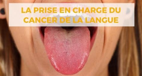 Cancer De La Langue Symptômes Diagnostic Et Traitement Centre