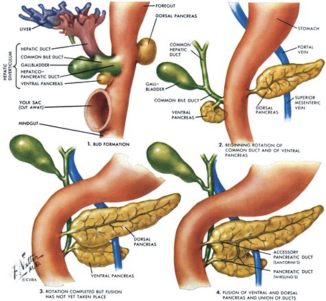Pancreas Divisum An Evidence Based Review Part I Pathophysiology
