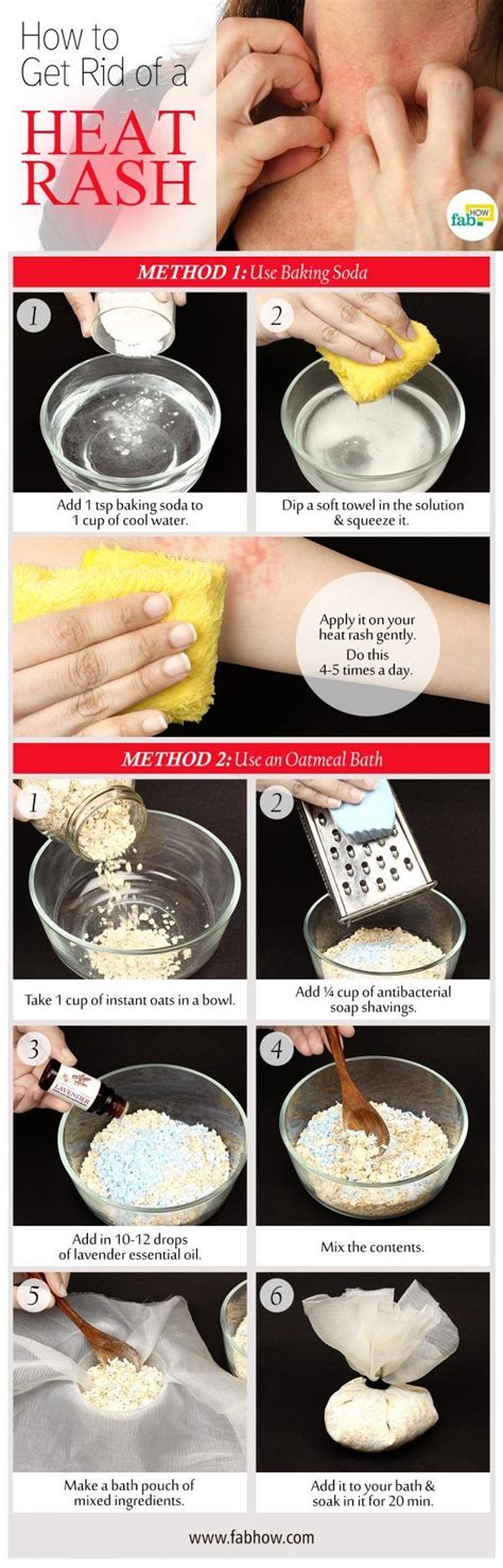 Best Home Remedy To Get Rid Of Heat Rash Quickly Face Rash Remedies