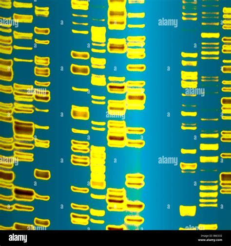 Dna Autoradiogram Artwork Stock Photo Alamy