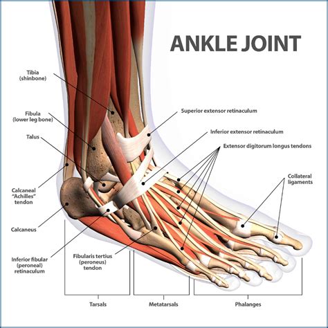 Ankle Fractures Broken Ankle Florida Orthopaedic Institute Ankle