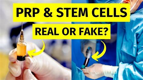 prp and stem cell therapy for beginners youtube