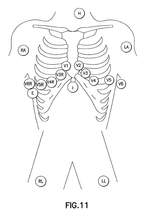 Pediatric Ekg 15 Lead Placement Diagram Diagram Back Muscles
