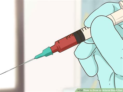 Https://tommynaija.com/draw/how To Draw A Venous Blood Gas