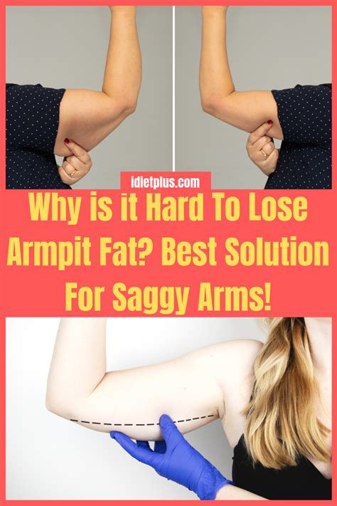 The Best How To Get Rid Of Armpit Fat Quickly References