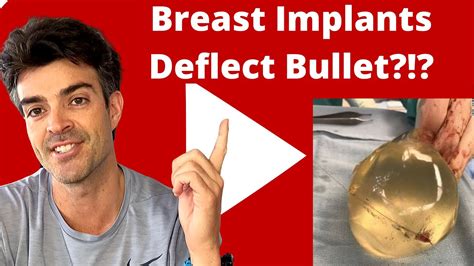 Womans Breast Implants Deflect Bullet Saving Her Life True Story