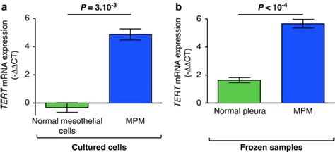 Maybe you would like to learn more about one of these? Overexpression and promoter mutation of the TERT gene in ...