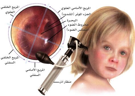 تعرفوا على التهاب الأذن الوسطى لدى الاطفال