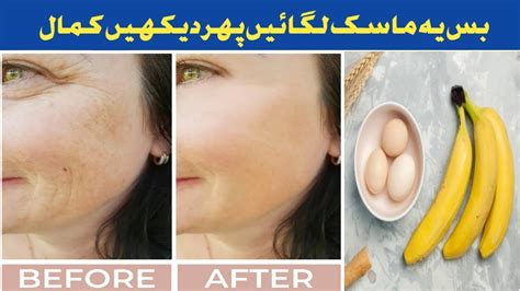 The Best Collagen Removes All Facial Wrinkles She Looks Younger 17 Years Old Fight Aging Youtube