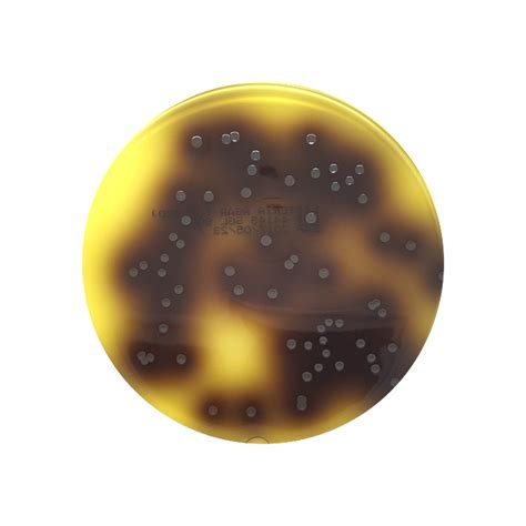 Listeriosis symptoms and signs include diarrhea, nausea, and fever. Listeria Selective Agar (OXFORD), 90mm Plate - Southern Group Laboratory