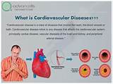 Photos of Cardiovascular Disease Symptoms And Treatment