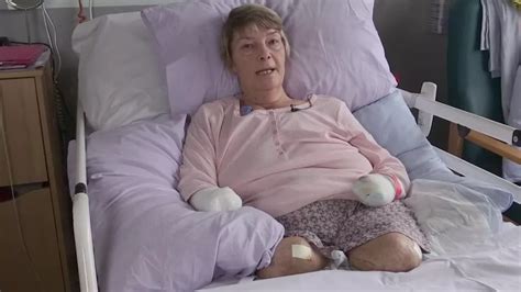 “please can we amputate all your limbs” devastating question doctors had to ask mum as she came