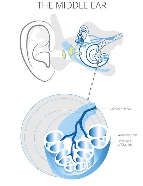 Sudden Hearing Loss Symptoms Causes And Treatment India