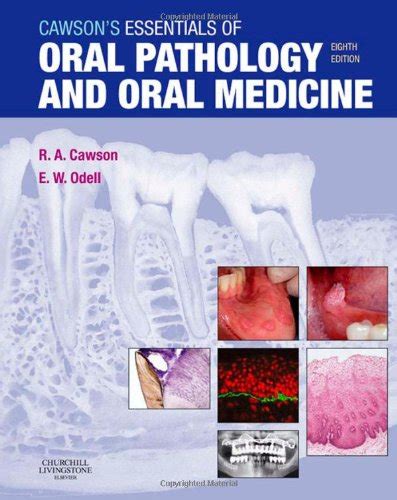 Cawsons Essentials Of Oral Pathology And Oral Medicine 8e