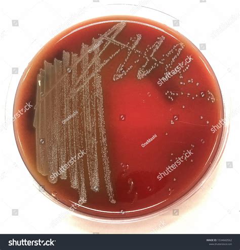 Alpha Hemolysis On Blood Agar Streptococcus Stock Photo