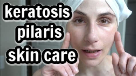 Keratosis Pilaris Treatment Products Dr Dray Youtube
