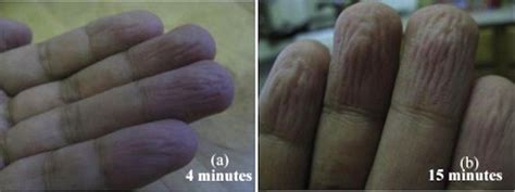 Wrinkles Help Wet Fingers Get A Grip Wired