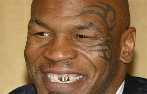 Mike Tyson Knocked Out The Gap Between His Teeth Complex