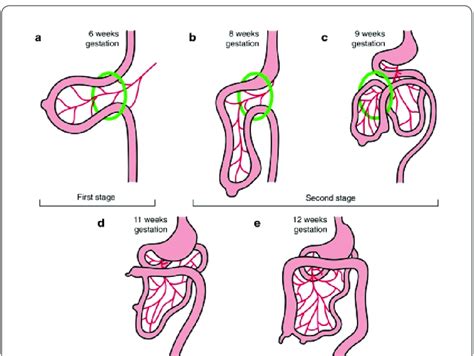 Stages Of Embryonic Rotation Of The Gut Used With Permission From