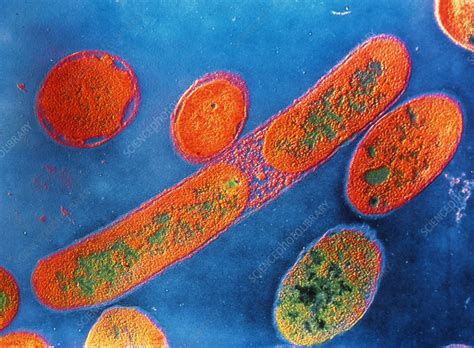 The bacteria takes advantage of an individual's weakened immune system to create an infection and this organism also produces. TEM of pseudomonas aeruginosa bacteria - Stock Image ...