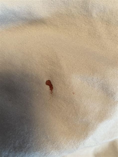 Does This Look Like Bed Bug Blood Smear Woke U Land Saw On Flat Sheet