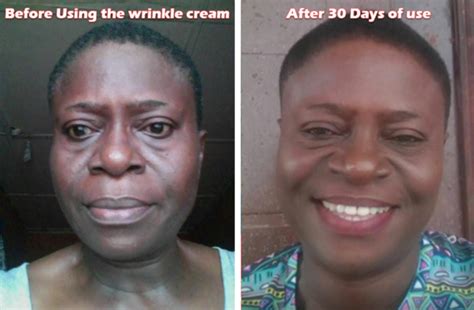 unbelievable see how a 56 year old woman got rid of her wrinkles