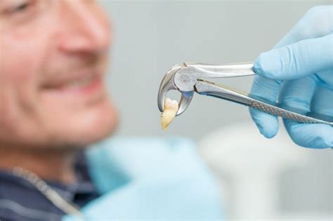 Tooth Extraction Recovery Healing And Aftercare Tips