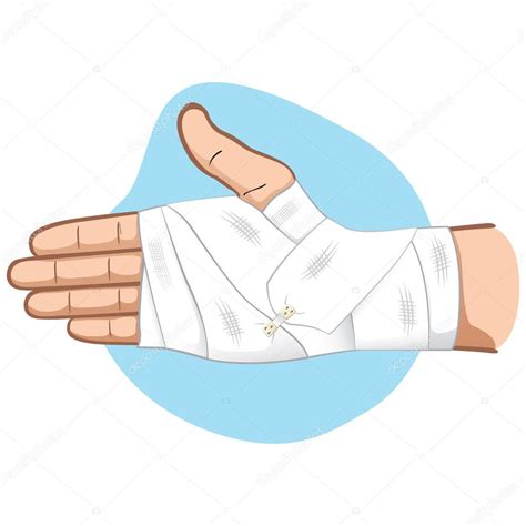 Illustration First Aid Hands With Bandage Bandage In The Palm And Wrist