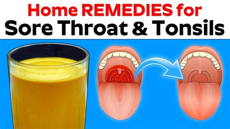 Best Over The Counter Medicine For Swollen Tonsils Tonsillitis Home