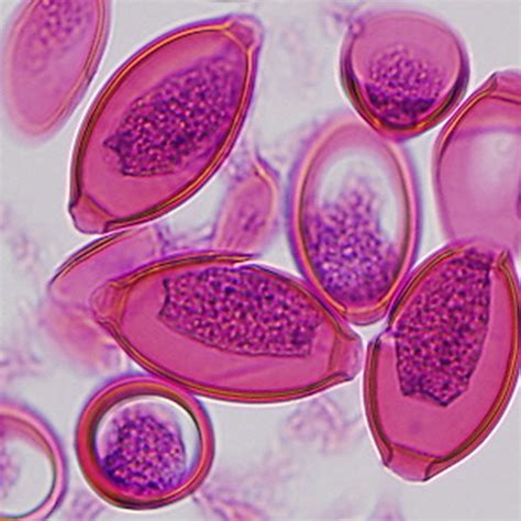 Image Of The Day Parasite Eggs The Scientist Magazine®