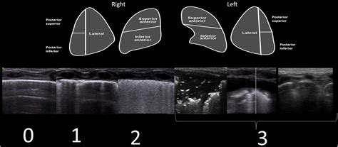 Frontiers Lung Ultrasound Characteristics In Neonates With Positive