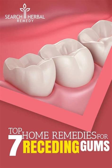 Top 7 Home Remedies For Receding Gums Oralgum Receding Gums Natural