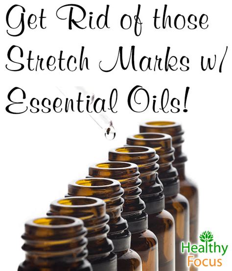 9 Proven Essential Oils For Stretch Marks Healthy Focus
