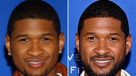 Usher Good Genes Or Good Docs