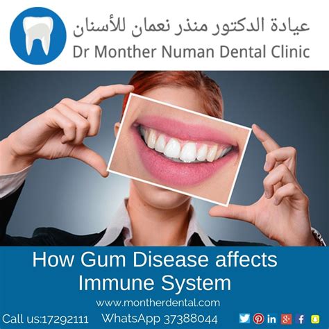 How Gum Disease Affects Immune System Doctor Monther Numan Dental Clinic