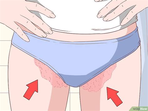 Mit diesen tipps beugst du wunden oberschenkeln vor! Come Capire se Hai la Tigna dell'Inguine: 8 Passaggi