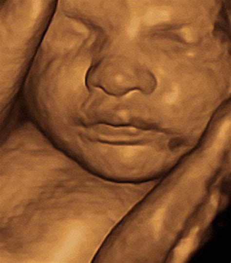 3d 30 Week Ultrasound What To Expect Crying Toddlers